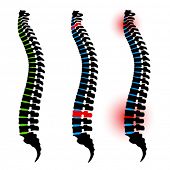 stock photo of science  - vector human spine silhouettes - JPG 
