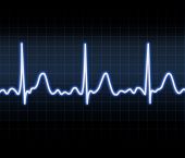 foto of heartbeat  - Heart monitor - JPG 