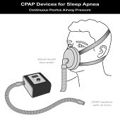 stock photo of pressure  - CPAP machine with air hose - JPG 